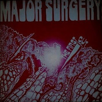 Major Surgery Mp3